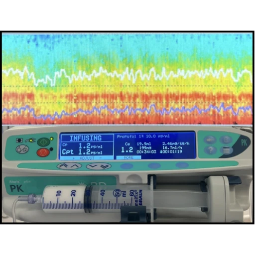 Wessex TIVA & EEG Training Day - 23rd Sept 2026